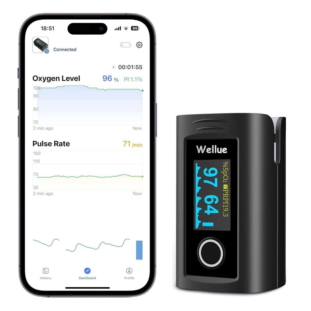 Test complet : viATOM Oxymètre Bluetooth & Stockage hors-ligne