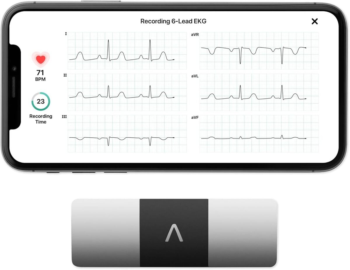 Test du AliveCor KardiaMobile 6L : le moniteur ECG connecté de poche