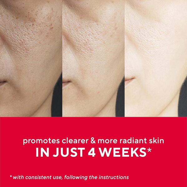 Mirabella Masque de luminothérapie à DEL 7 couleurs pour le visage avec lumière proche infrarouge – Sans fil, rechargeable, multicolore et rouge pour l'acné, les rides et les soins de la peau (1