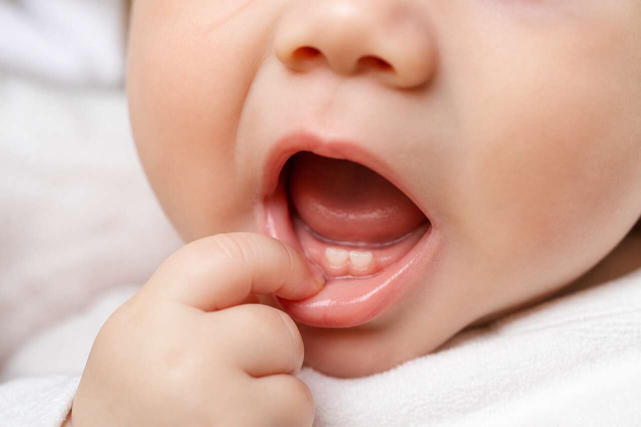 Éruptions dentaires chez l'enfant : guide complet